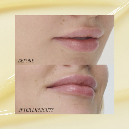 Liplights - Overnight Lip Mask